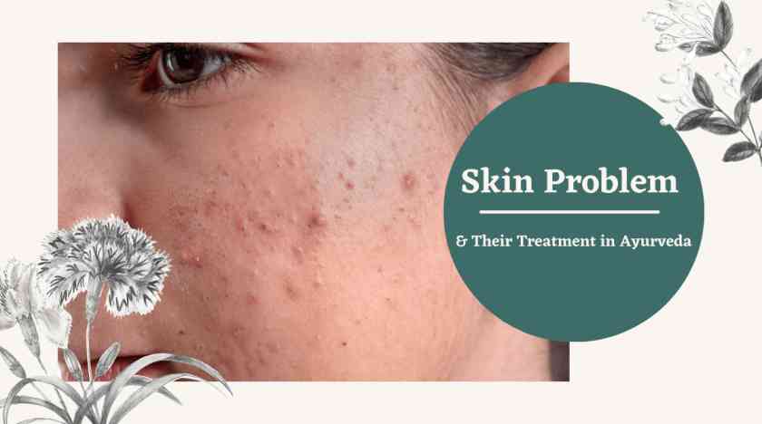 Skin Problem